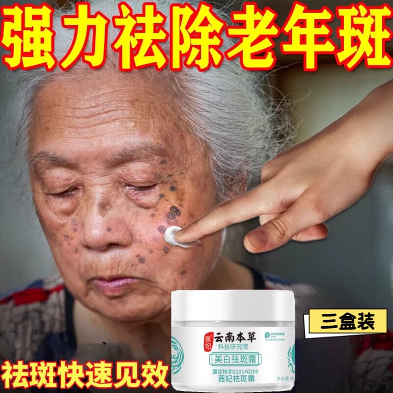 佰束点痣老年班去老人斑专用除老年黑班点斑霜黄褐斑强力祛除手部脸部 其它肤质 三盒超值装 胖线上商城超市营金榜第一正